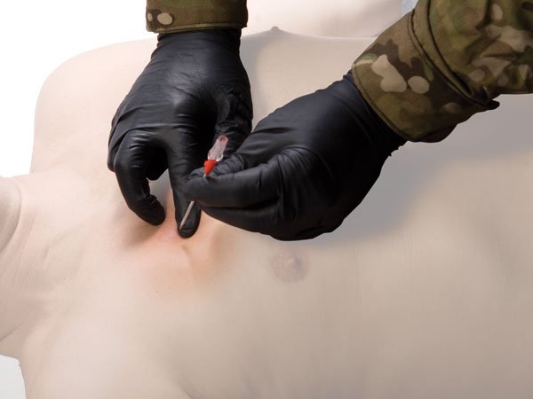 TyTek Medical Inc. TYT Medic. T-PAK Dekomp-Nadel Pneumothoraxentlast. Gr. 14G